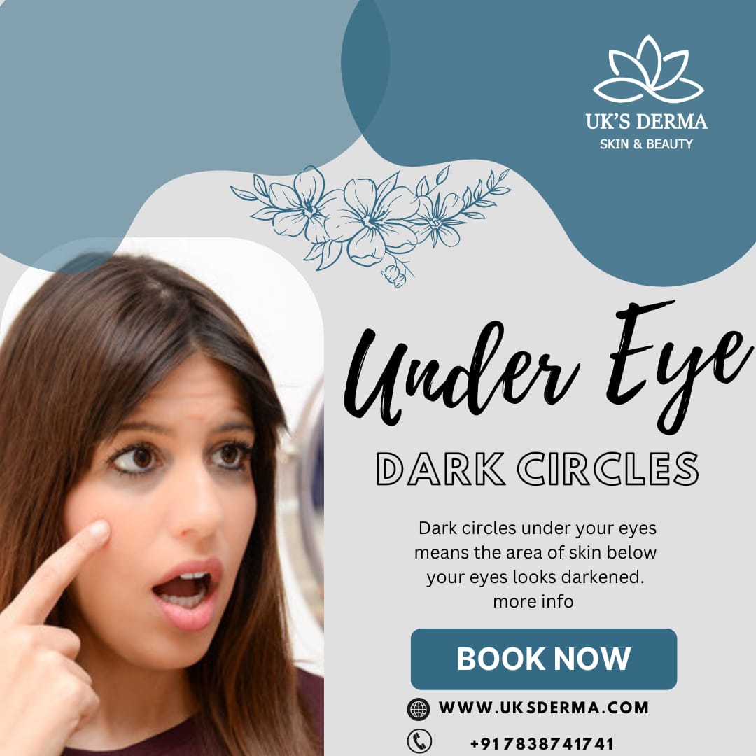 under eye treatment in delhi
