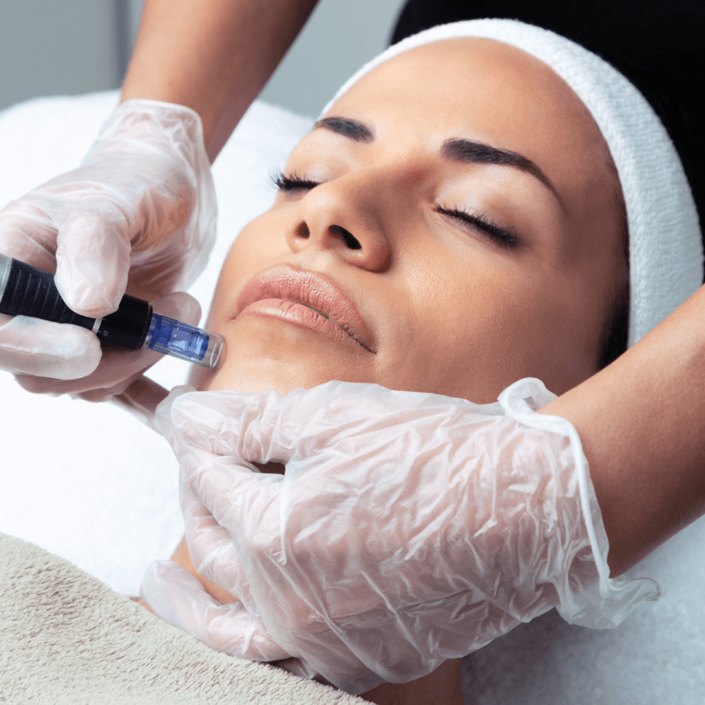 microneedling in prashant vihar