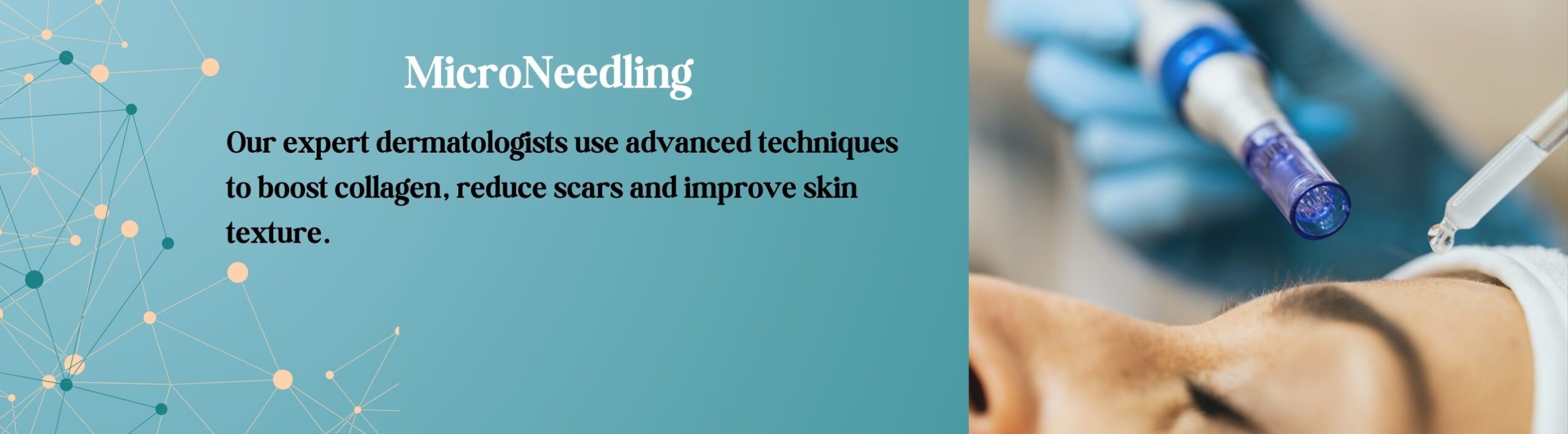 Microneedling Treatment In Madhuban Chowk