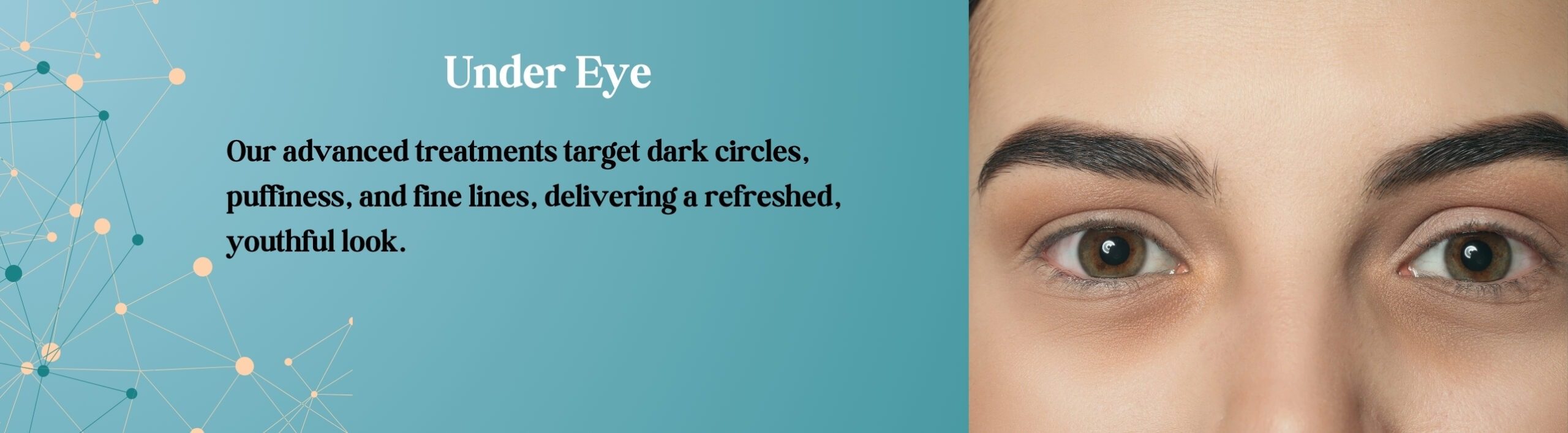 Under Eye Fillers in Prashant vihar