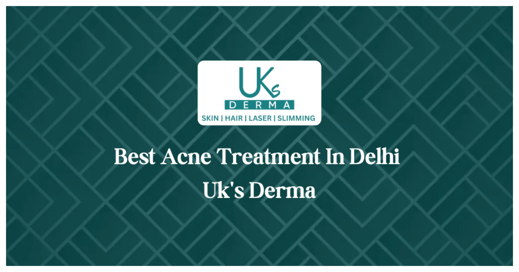 Best Acne Treatment In Delhi Uk's Derma