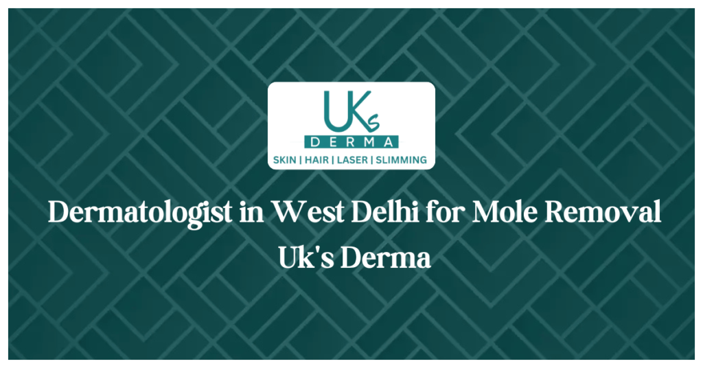 Dermatologist in West Delhi for Mole Removal Uk's Derma